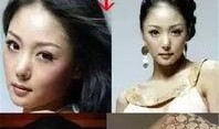 鼻子整坏女星爆料视频,鼻子整形女星爆料视频引发热议